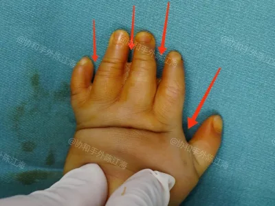 Les examens prénatals ont révélé que la tête du bébé était petite, mais après...