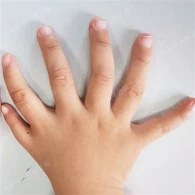 Chirurgie de la main miroir